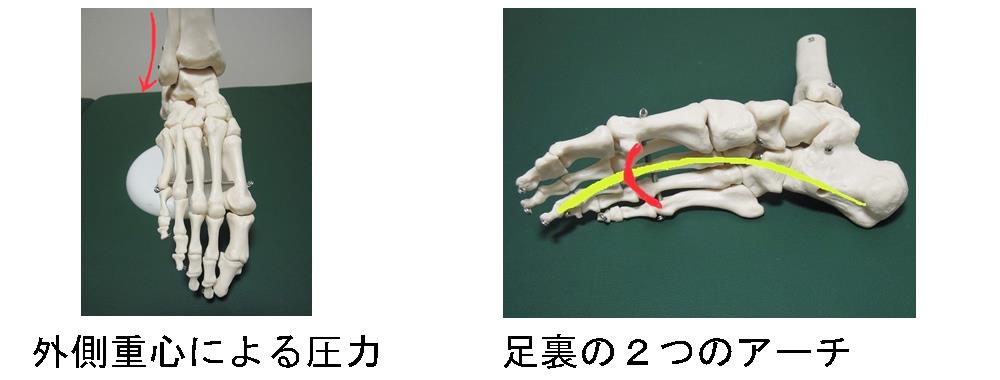 その側重心による腓骨への圧力と、足裏のアーチ。