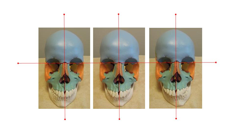 奈良県の自律神経専門整体院の顎関節画像１