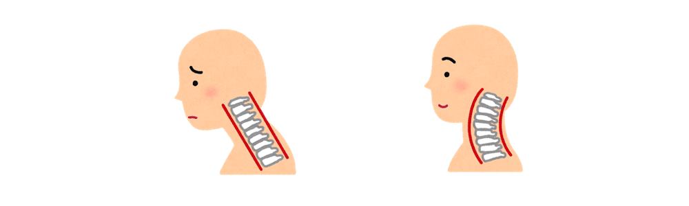 ストレートネック、不安、イライラ、落ち着かない