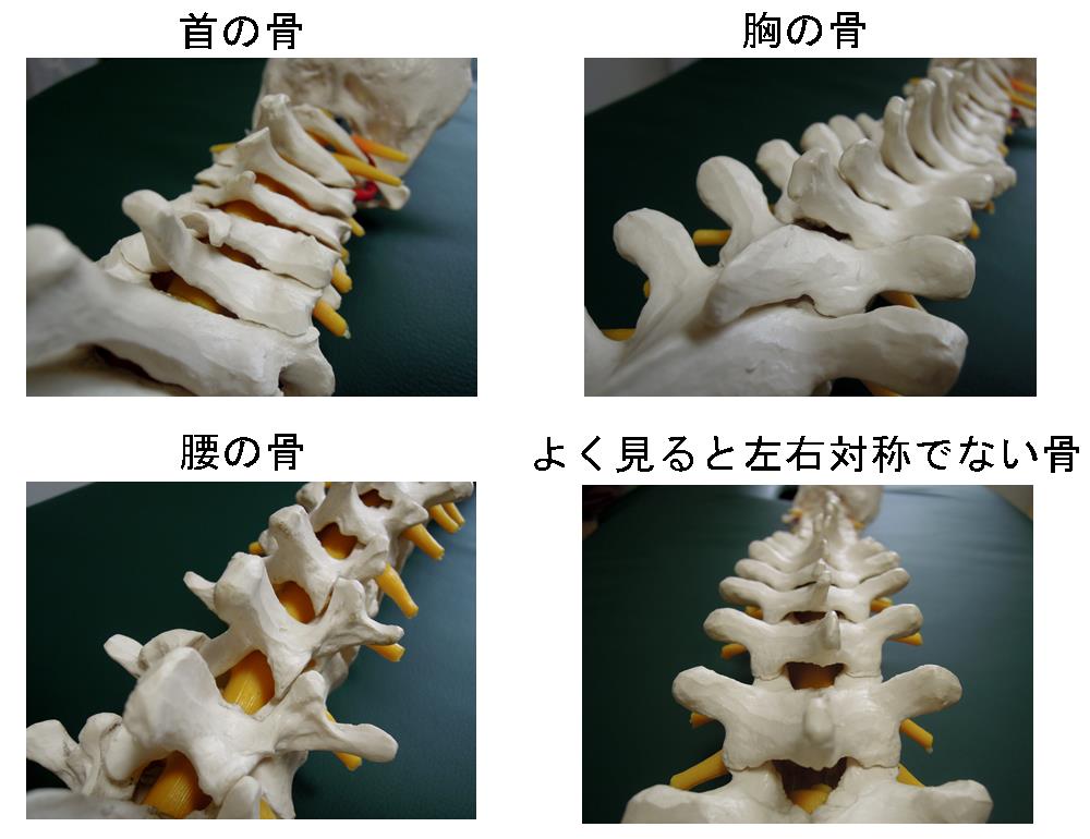 左右対称ではない骨の形状