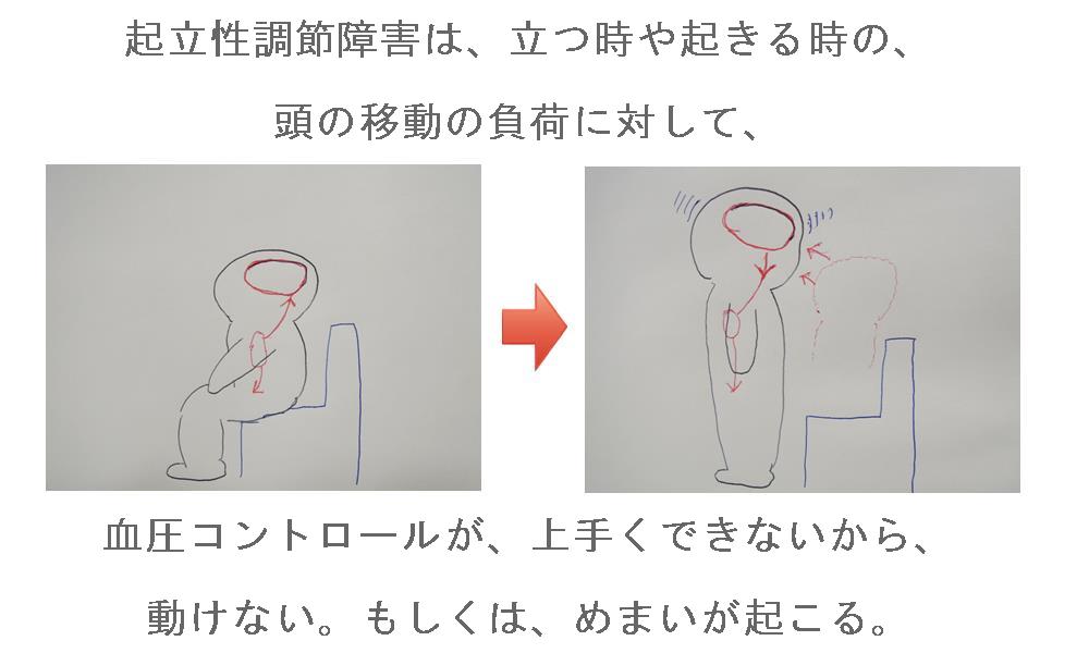 起立性調節障害による眩暈や立ちくらみ