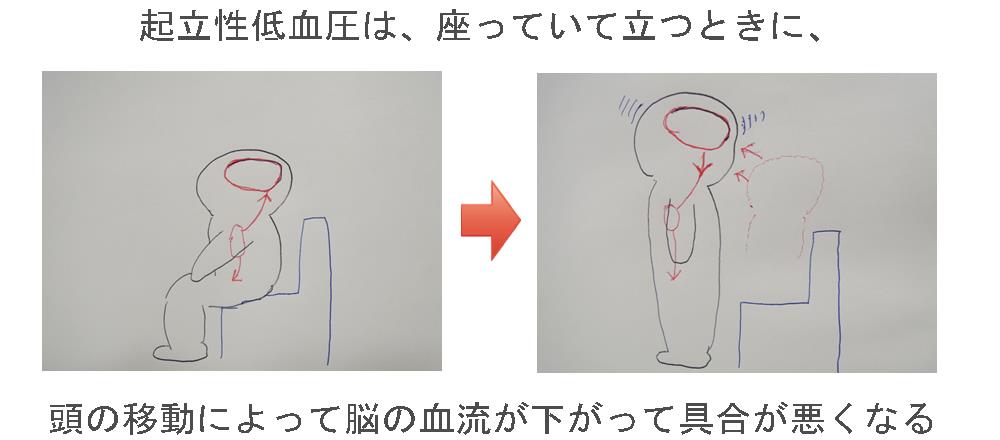 起立性低血圧による立ちくらみの動き