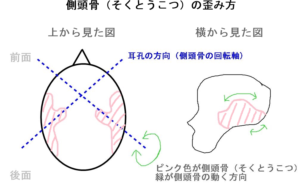 側頭骨の歪み方の調整
